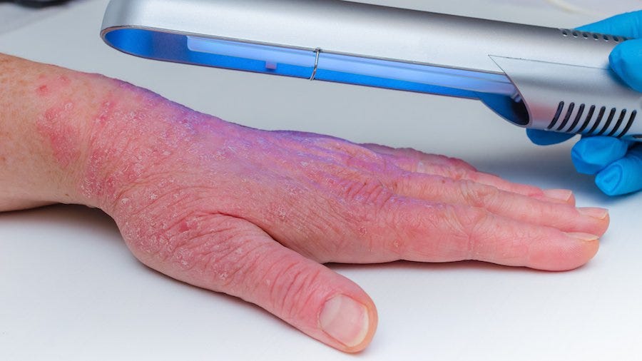 The NonTopical Treatment Options for Psoriasis